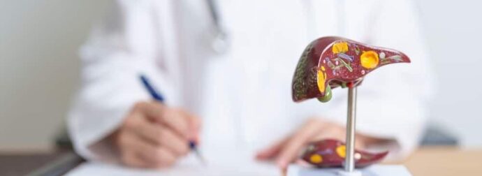 Λιπώδες ήπαρ: Αιτίες, συμπτώματα, θεραπεία και σπιτικές θεραπείες