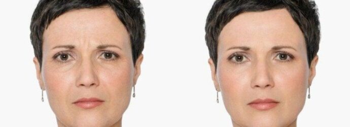 Κλιμακτήριος: 11 συμβουλές των ειδικών για να διατηρήσετε τη νεότητά σας κατά τη διάρκεια της εμμηνόπαυσης