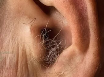 To γνωρίζατε; Αν φυτρώνουν τρίχες στα αυτιά σας, αυτό συμβαίνει επειδή το σώμα σας…