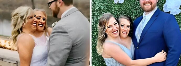 Σιαμαίες δίδυμες που παντρεύτηκαν τον ίδιο άντρα έδειξαν φωτογραφίες με τον σύζυγό τους και την κόρη τους