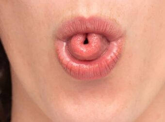 Τι σημαίνει ψυχολογικά η ικανότητα να διπλώνεις τη γλώσσα σου σε σχήμα «U»