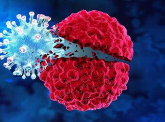 Ποιο το ελληνıκό όσπριο που μεıώνει τον κίνδuνο εμφάνıσης καpκίνου. Θαuματουργό