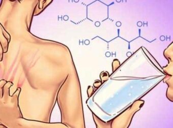 Αυτά είναι τα 8 σημάδια που δείχνουν ότι έχετε υπερβολική ζάχαρη στο σώμα σας