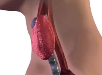 Σταματήστε να τρώτε αμέσως αυτά τα 6 τρόφιμα που χειροτερεύουν τον θυρεοειδή