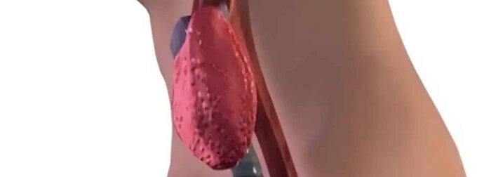 Σταματήστε να τρώτε αμέσως αυτά τα 6 τρόφιμα που χειροτερεύουν τον θυρεοειδή