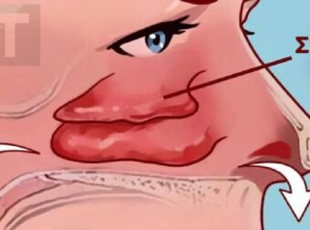 Πώς να καθαρίσετε τα ιγμόρεια σας μόνο με τα δάχτυλά σας