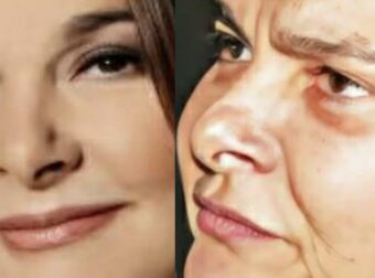 Αγνώριστη σήμερα στα 65 η πασίγνωστη τραγουδίστρια μεγάλων επιτυχιών