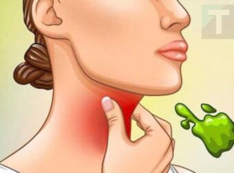 Οι πραγματικές αιτίες του συνεχούς φλέγματος στο λαιμό και πώς να απαλλαγείτε από αυτό