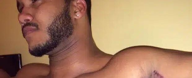 Εκεί που έκανε μπάνιο, ένιωσε κάτι να τον καίει κάτω από τη μασχάλη. Δεν ήταν όμως το σαπούνι…