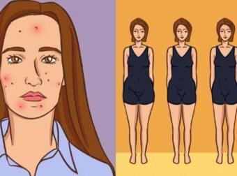 Θυρεοειδής και εμμηνόπαυση: Ποια είναι η σχέση τους και τι δείχνουν οι έρευνες