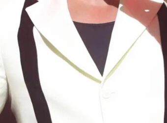 Tpόμος για πασίγνωστο Έλληνα τραγουδιστή – Τον χτύπτησαν στο πρόσωπο