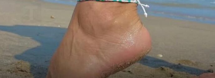 Τι λέει πραγματικά το βραχιολάκι στον αστράγαλό σας για εσάς — είναι περισσότερο από ένα απλό κόσμημα