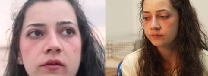 Ισπανία: Η Νοέλια Καστίγιο μόλις 25 ετών, πέθανε – Όλος ο πλανήτης δάκρυσε με την ιστορία της