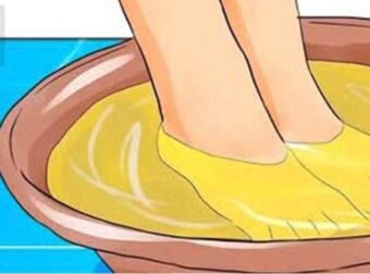 Βουτήξτε τα πόδια σας σε ξίδι μία φορά την εβδομάδα και πείτε αντίο σε αυτά τα 9 προβλήματα