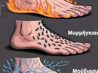Σημάδια των ΠΟΔΙΩΝ σας που δείχνουν…