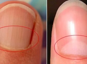 Τι πραγματικά είναι το ημισέληνο στη βάση των νυχιών σας;