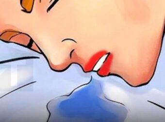 Σιαλόρροια στον ύπνο: Πότε είναι αθώα και πότε κρύβει προβλήματα υγείας