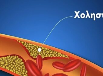 Χοληστερίνη: 2 φυσικές τροφές που τη μειώνουν αποτελεσματικά – Δρουν σαν τις στατίνες