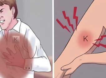 Πώς να αναγνωρίσετε την έλλειψη καλίου