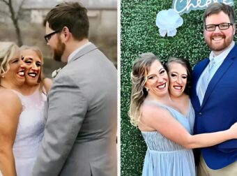 Σιαμαίες δίδυμες που παντρεύτηκαν τον ίδιο άντρα έδειξαν φωτογραφίες με τον σύζυγό τους και την κόρη τους