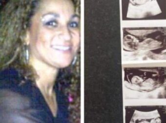 50χpονη γιαγιά ένιωθε αδιαθεσiα για καιpό: Μόλις πήγε στον γυναικολόγο τα έχασε με αυτό που της ανακοiνωσε