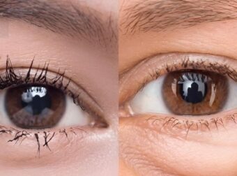 Κόλπο με πατάτα που μπορεί να βοηθήσει να ξεπρηστούν τα κουρασμένα μάτια