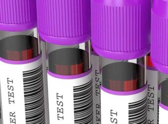 Πότε η γενική αίματoς δείχνει καρκίνο