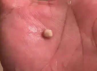 Να τι πρέπει να γνωρίζετε για αυτές τις πέτρες – Που εμφανίζονται