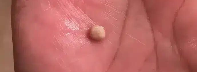 Να τι πρέπει να γνωρίζετε για αυτές τις πέτρες – Που εμφανίζονται