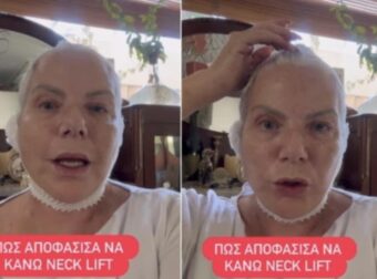 Νανά Παλαιτσάκη: Το ιατρικό ζήτημα που την οδήγησε στο χειρουργείο, το λίφτινγκ λαιμού και το ηχηρό μήνυμα προς όλες τις γυναίκες