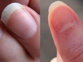 Τι πραγματικά είναι το ημισέληνο στη βάση των νυχιών σας;