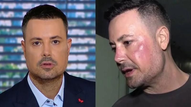 Πέτρος Κουσουλός: Τι είναι η γυροειδής αλωπεκία που τον ταλαιπωρεί – Η μάχη με το αυτοάνοσο και η νέα διάγνωση