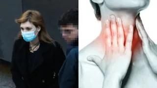 Ρούλα Πισπιρίγκου: Τι είναι ο καρκίνος του λάρυγγα – Μια βραχνάδα μπορεί να είναι το πρώτο καμπανάκι, πόσοι ασθενείς επιβιώνουν;